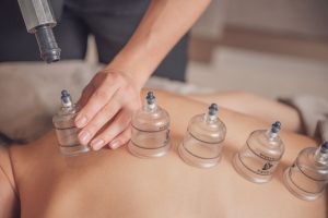 Myofascial Cupping